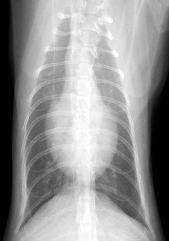 x ray of heart