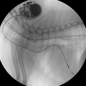 X-ray image of a pacemaker inside a dog’s heart